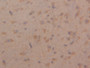 DAB staining on IHC-P; Samples: Mouse Cerebrum Tissue)