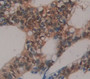 Polycomb Group Ring Finger Protein 4 (PCGF4) Polyclonal Antibody, Cat#CAU22416 Polycomb Group Ring Finger Protein 4 (PCGF4) Polyclonal Antibody, Cat#CAU22416