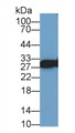 Western Blot; Sample: Human Lung lysate; Primary Ab: 1µg/ml Rabbit Anti-Human VAPA Antibody Second Ab: 0.2µg/mL HRP-Linked Caprine Anti-Rabbit IgG Polyclonal Antibody Western Blot; Sample: Human Lung lysate; Primary Ab: 1µg/ml Rabbit Anti-Human VAPA Antibody Second Ab: 0.2µg/mL HRP-Linked Caprine Anti-Rabbit IgG Polyclonal Antibody