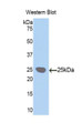 Western Blot; Sample: Recombinant protein. Western Blot; Sample: Recombinant protein.