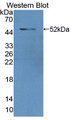 Western Blot; Sample: Recombinant protein.