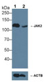 Knockout Varification: <br/>Lane 1: Wild-type Jurkat cell lysate; <br/>Lane 2: JAK2 knockout Jurkat cell lysate; <br/>Predicted MW: 130kDa <br/>Observed MW: 130kDa<br/>Primary Ab: 3µg/ml Rabbit Anti-Human JAK2 Antibody<br/>Second Ab: 0.2µg/mL HRP-Linked Caprine Anti-Rabbit IgG Polyclonal Antibody<br/> Knockout Varification: <br/>Lane 1: Wild-type Jurkat cell lysate; <br/>Lane 2: JAK2 knockout Jurkat cell lysate; <br/>Predicted MW: 130kDa <br/>Observed MW: 130kDa<br/>Primary Ab: 3µg/ml Rabbit Anti-Human JAK2 Antibody<br/>Second Ab: 0.2µg/mL HRP-Linked Caprine Anti-Rabbit IgG Polyclonal Antibody<br/>