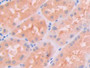 DAB staining on IHC-P; Samples: Human Kidney Tissue; Primary Ab: 30µg/ml Rabbit Anti-Human JAK2 Antibody Second Ab: 2µg/mL HRP-Linked Caprine Anti-Rabbit IgG Polyclonal Antibody DAB staining on IHC-P; Samples: Human Kidney Tissue; Primary Ab: 30µg/ml Rabbit Anti-Human JAK2 Antibody Second Ab: 2µg/mL HRP-Linked Caprine Anti-Rabbit IgG Polyclonal Antibody