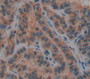 Histatin 1 (HTN1) Polyclonal Antibody, Cat#CAU22480 Histatin 1 (HTN1) Polyclonal Antibody, Cat#CAU22480