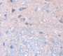 Fibulin 3 (FBLN3) Polyclonal Antibody, Cat#CAU22497 Fibulin 3 (FBLN3) Polyclonal Antibody, Cat#CAU22497