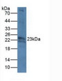 Western Blot; Sample: Mouse Eye Tissue. Western Blot; Sample: Mouse Eye Tissue.
