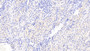 DAB staining on IHC-P; Samples: Human Kidney Tissue;  Primary Ab: 20μg/ml Rabbit Anti-Human CSRP1 Antibody Second Ab: 2µg/mL HRP-Linked Caprine Anti-Rabbit IgG Polyclonal Antibody  DAB staining on IHC-P; Samples: Human Kidney Tissue;  Primary Ab: 20μg/ml Rabbit Anti-Human CSRP1 Antibody Second Ab: 2µg/mL HRP-Linked Caprine Anti-Rabbit IgG Polyclonal Antibody