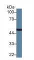Western Blot; Sample: Human A549 cell lysate; ;Primary Ab: 1.5µg/ml Rabbit Anti-Human CPN1 Antibody;Second Ab: 0.2µg/mL HRP-Linked Caprine Anti-Rabbit IgG Polyclonal Antibody; Western Blot; Sample: Human A549 cell lysate; ;Primary Ab: 1.5µg/ml Rabbit Anti-Human CPN1 Antibody;Second Ab: 0.2µg/mL HRP-Linked Caprine Anti-Rabbit IgG Polyclonal Antibody;