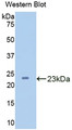 Western Blot; Sample: Recombinant protein. Western Blot; Sample: Recombinant protein.