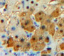 Used in DAB staining on fromalin fixed paraffin-embedded Liver tissue Used in DAB staining on fromalin fixed paraffin-embedded Liver tissue