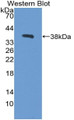 Western Blot; Sample: Recombinant protein. Western Blot; Sample: Recombinant protein.