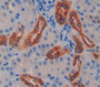Fucosyltransferase 8 (FUT8) Polyclonal Antibody, Cat#CAU22575 Fucosyltransferase 8 (FUT8) Polyclonal Antibody, Cat#CAU22575