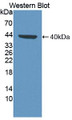 Western Blot; Sample: Recombinant protein. Western Blot; Sample: Recombinant protein.