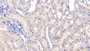 DABstainingonIHC-P.Samples:RatTissue) DABstainingonIHC-P.Samples:RatTissue)