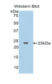 Western Blot; Sample: Recombinant protein. Western Blot; Sample: Recombinant protein.
