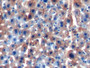DAB staining on IHC-P; Samples: Mouse Liver Tissue;  Primary Ab: 10µg/ml Rabbit Anti-Mouse ALDH7A1 A DAB staining on IHC-P; Samples: Mouse Liver Tissue;  Primary Ab: 10µg/ml Rabbit Anti-Mouse ALDH7A1 A
