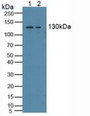 Western Blot; Sample: Lane1: Human Hela Cells; Lane2: Human K562 Cells. Western Blot; Sample: Lane1: Human Hela Cells; Lane2: Human K562 Cells.