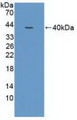 Western Blot; Sample: Recombinant NCOA3, Human. Western Blot; Sample: Recombinant NCOA3, Human.