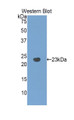 Western Blot; Sample: Recombinant protein. Western Blot; Sample: Recombinant protein.