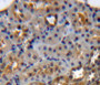 DAB staining on fromalin fixed paraffin-embedded kidney tissue) DAB staining on fromalin fixed paraffin-embedded kidney tissue)