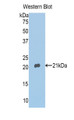 Western Blot; Sample: Recombinant protein.
