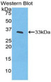 Western Blot; Sample: Recombinant protein. Western Blot; Sample: Recombinant protein.