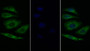 FITC staining on IF; Sample: Human HepG2 cell;  Primary Ab: 20μg/ml Rabbit Anti-Human IL20Rb Antibody Second Ab: 1.5μg/ml FITC-Linked Caprine Anti-Rabbit IgG Polyclonal Antibody  FITC staining on IF; Sample: Human HepG2 cell;  Primary Ab: 20μg/ml Rabbit Anti-Human IL20Rb Antibody Second Ab: 1.5μg/ml FITC-Linked Caprine Anti-Rabbit IgG Polyclonal Antibody