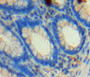 DAB staining on fromalin fixed paraffin-embedded rectum tissue) DAB staining on fromalin fixed paraffin-embedded rectum tissue)