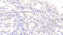 DABstainingonIHC-P.Samples:HumanTissue) DABstainingonIHC-P.Samples:HumanTissue)