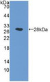 Western Blot; Sample: Recombinant NAAA, Human. Western Blot; Sample: Recombinant NAAA, Human.