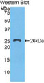Western Blot; Sample: Recombinant protein.