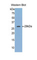 Western Blot; Sample: Recombinant protein. Western Blot; Sample: Recombinant protein.