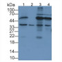 Western Blot; Sample: Lane1: Mouse Liver lysate; Lane2: Mouse Placenta lysate; Lane3: Human Hela cell lysate; Lane4: Human Jurkat cell lysate;; Primary Ab: 1µg/mL Rabbit Anti-Human FKBP8 Antibody; Second Ab: 0.2µg/mL HRP-Linked Caprine Anti-Rabbit IgG Polyclonal Antibody; Western Blot; Sample: Lane1: Mouse Liver lysate; Lane2: Mouse Placenta lysate; Lane3: Human Hela cell lysate; Lane4: Human Jurkat cell lysate;; Primary Ab: 1µg/mL Rabbit Anti-Human FKBP8 Antibody; Second Ab: 0.2µg/mL HRP-Linked Caprine Anti-Rabbit IgG Polyclonal Antibody;