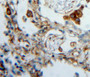 Used in DAB staining on fromalin fixed paraffin-embedded lung tissue Used in DAB staining on fromalin fixed paraffin-embedded lung tissue