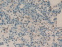 DAB staining on IHC-P; Samples: Rat Lung Tissue DAB staining on IHC-P; Samples: Rat Lung Tissue
