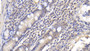 DAB staining on fromalin fixed paraffin- embedded kidney tissue)