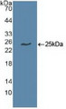Western Blot; Sample: Recombinant UBE2C, Human. Western Blot; Sample: Recombinant UBE2C, Human.