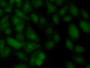 FITC staining on IF; Samples: Human Hela Cells;  Primary Ab: 20µg/ml Rabbit Anti-Human UBE2C Antibod FITC staining on IF; Samples: Human Hela Cells;  Primary Ab: 20µg/ml Rabbit Anti-Human UBE2C Antibod