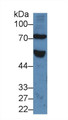 Western Blot; Sample: Human Serum; Primary Ab: 5µg/ml Rabbit Anti-Human FZD1 Antibody Second Ab: 0.2µg/mL HRP-Linked Caprine Anti-Rabbit IgG Polyclonal Antibody Western Blot; Sample: Human Serum; Primary Ab: 5µg/ml Rabbit Anti-Human FZD1 Antibody Second Ab: 0.2µg/mL HRP-Linked Caprine Anti-Rabbit IgG Polyclonal Antibody