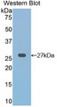 Western Blot; Sample: Recombinant protein. Western Blot; Sample: Recombinant protein.