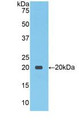 Western Blot; Sample: Recombinant NCCT, Human. Western Blot; Sample: Recombinant NCCT, Human.