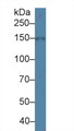 Western Blot; Sample: Porcine Kidney lysate; Primary Ab: 1µg/ml Rabbit Anti-Human NCCT Antibody Second Ab: 0.2µg/mL HRP-Linked Caprine Anti-Rabbit IgG Polyclonal Antibody Western Blot; Sample: Porcine Kidney lysate; Primary Ab: 1µg/ml Rabbit Anti-Human NCCT Antibody Second Ab: 0.2µg/mL HRP-Linked Caprine Anti-Rabbit IgG Polyclonal Antibody