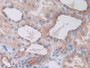DAB staining on IHC-P; Samples: Human Kidney Tissue; Primary Ab: 10µg/ml Rabbit Anti-Human NCCT Antibody Second Ab: 2µg/mL HRP-Linked Caprine Anti-Rabbit IgG Polyclonal Antibody DAB staining on IHC-P; Samples: Human Kidney Tissue; Primary Ab: 10µg/ml Rabbit Anti-Human NCCT Antibody Second Ab: 2µg/mL HRP-Linked Caprine Anti-Rabbit IgG Polyclonal Antibody