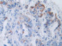 DAB staining on fromalin fixed paraffin- embedded kidney tissue) DAB staining on fromalin fixed paraffin- embedded kidney tissue)