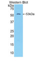 Western Blot; Sample: Recombinant protein. Western Blot; Sample: Recombinant protein.