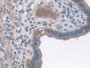 DAB staining on IHC-P; Samples: Mouse Uterus Tissue; Primary Ab: 10µg/ml Rabbit Anti-Mouse IQGAP1 Antibody Second Ab: 2µg/mL HRP-Linked Caprine Anti-Rabbit IgG Polyclonal Antibody DAB staining on IHC-P; Samples: Mouse Uterus Tissue; Primary Ab: 10µg/ml Rabbit Anti-Mouse IQGAP1 Antibody Second Ab: 2µg/mL HRP-Linked Caprine Anti-Rabbit IgG Polyclonal Antibody