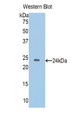 Western Blot; Sample: Recombinant protein. Western Blot; Sample: Recombinant protein.