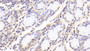 DAB staining on IHC-P; Samples: Human Stomach Tissue; Primary Ab: 20μg/ml Rabbit Anti-Human HGD Antibody Second Ab: 2µg/mL HRP-Linked Caprine Anti-Rabbit IgG Polyclonal Antibody DAB staining on IHC-P; Samples: Human Stomach Tissue; Primary Ab: 20μg/ml Rabbit Anti-Human HGD Antibody Second Ab: 2µg/mL HRP-Linked Caprine Anti-Rabbit IgG Polyclonal Antibody