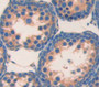 Beta-Carotene-15,15'-Monooxygenase 1 (bCMO1) Polyclonal Antibody, Cat#CAU22875 Beta-Carotene-15,15'-Monooxygenase 1 (bCMO1) Polyclonal Antibody, Cat#CAU22875