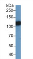 Western Blot; Sample: Porcine Cerebrum lysate; Primary Ab: 1µg/ml Rabbit Anti-Human EPHA4 Antibody Second Ab: 0.2µg/mL HRP-Linked Caprine Anti-Rabbit IgG Polyclonal Antibody Western Blot; Sample: Porcine Cerebrum lysate; Primary Ab: 1µg/ml Rabbit Anti-Human EPHA4 Antibody Second Ab: 0.2µg/mL HRP-Linked Caprine Anti-Rabbit IgG Polyclonal Antibody